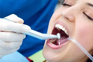 Root Canal Treatment - Malatya Diş